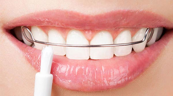 ارتودنسی متحرک