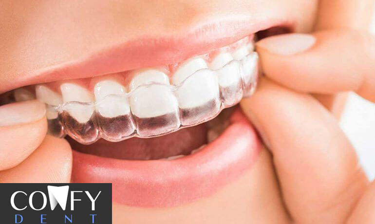 ارتودنسی نامرئی چیست